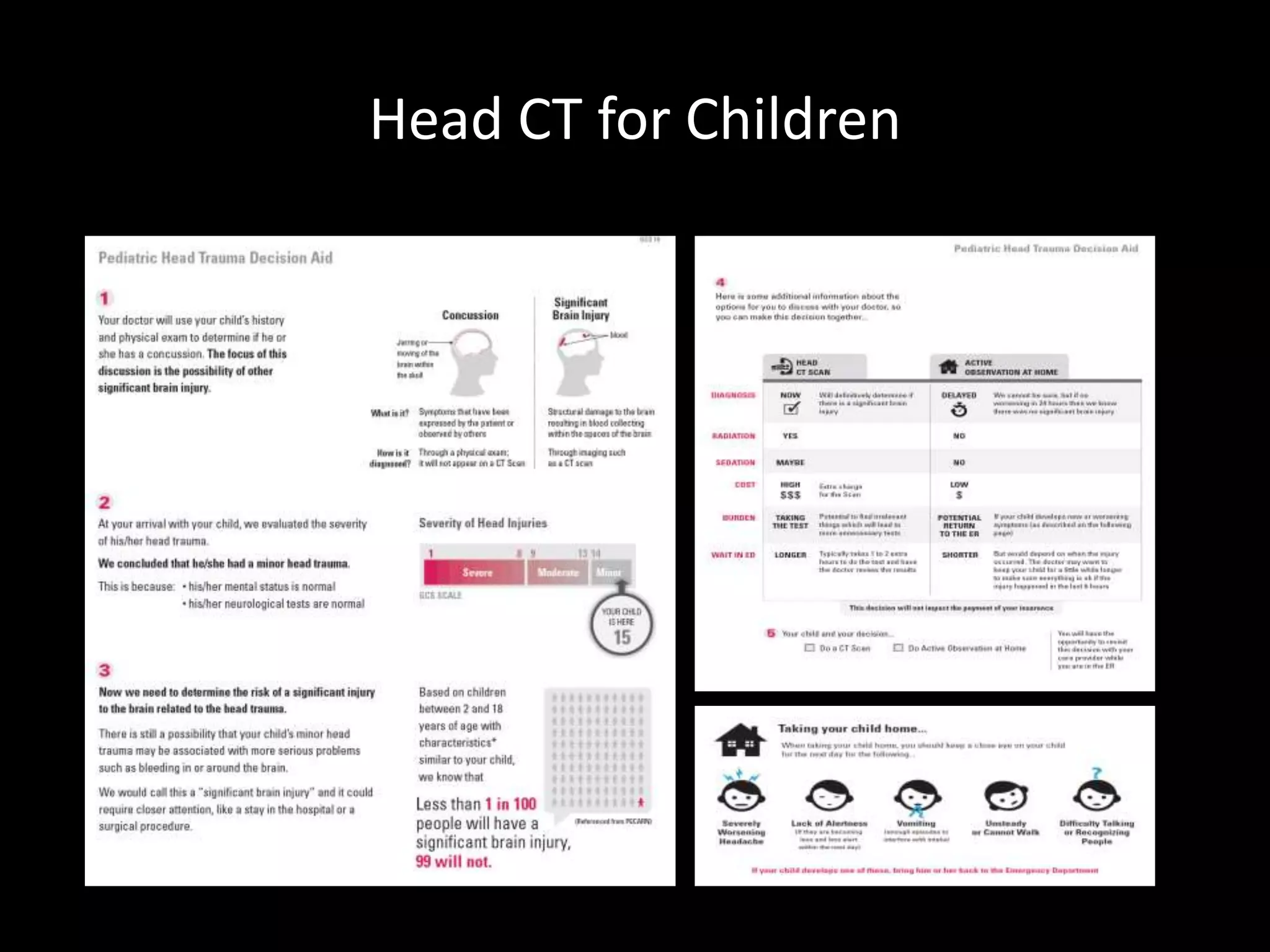 Head CT for Children
 