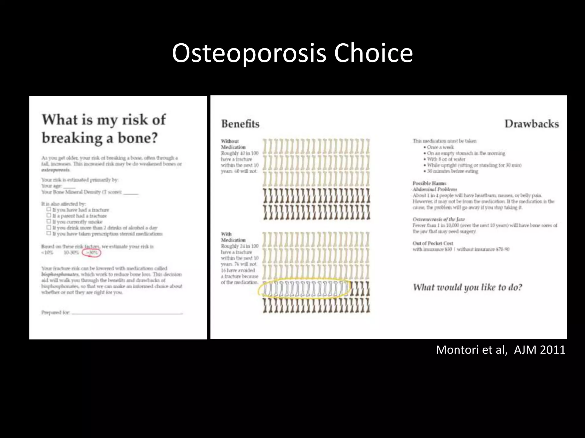Osteoporosis Choice




                      Montori et al, AJM 2011
 