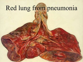 Spanish Flu Alice.Im