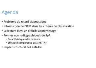 Agenda
• Problème du retard diagnostique
• Introduction de l’IRM dans les critères de classification
• La lecture IRM: un ...