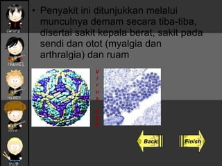Penyakit ini ditunjukkan melalui munculnya demam secara tiba-tiba, disertai sakit kepala berat, sakit pada sendi dan otot (myalgia dan arthralgia) dan ruam   Back Finish V i r u s D B D 