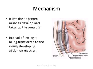 Mechanism
• It lets the abdomen
muscles develop and
takes up the pressure.

• Instead of letting it
being transferred to the
slowly developing
abdomen muscles.

Technical Textile Society-NTU

 