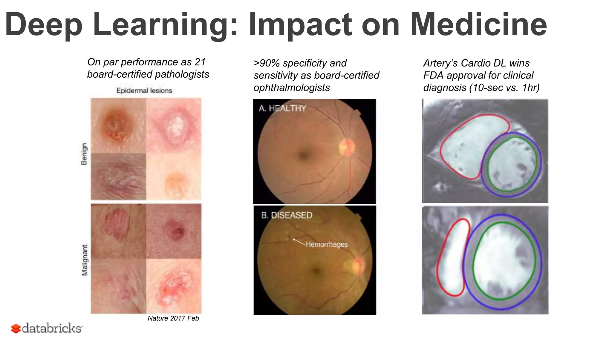 Deep Learning: Impact on Medicine
On par performance as 21
board-certified pathologists
Nature 2017 Feb
>90% specificity and
sensitivity as board-certified
ophthalmologists
Artery’s Cardio DL wins
FDA approval for clinical
diagnosis (10-sec vs. 1hr)
 