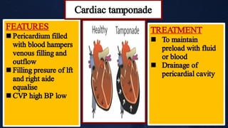 


FEATURES
Pericardium filled
with blood hampers
venous filling and
outflow
Filling presure of lft
and right aide
equalise
CVP high BP low


TREATMENT
To maintain
preload with fluid
or blood
Drainage of
pericardial cavity
Cardiac tamponade
 