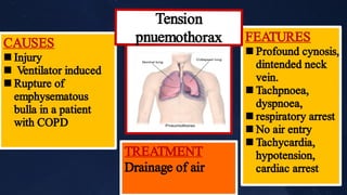 




FEATURES
Profound cynosis,
dintended neck
vein.
Tachpnoea,
dyspnoea,
respiratory arrest
No air entry
Tachycardia,
hypotension,
cardiac arrest



CAUSES
Injury
Ventilator induced
Rupture of
emphysematous
bulla in a patient
with COPD
Tension
pnuemothorax
TREATMENT
Drainage of air
 