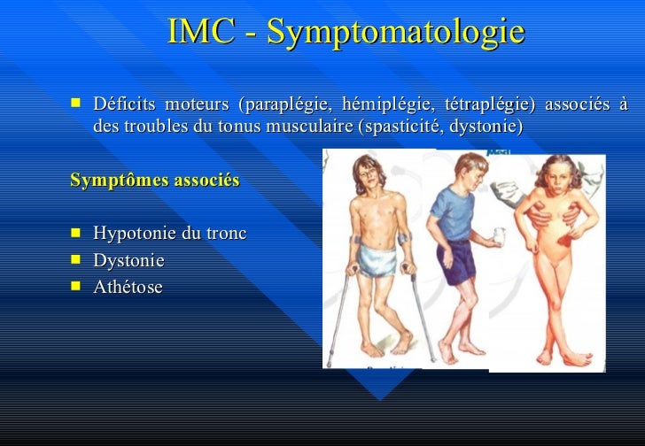 Spasticité Quels Sont Les Symptômes De La Spasticité – CDOBZY