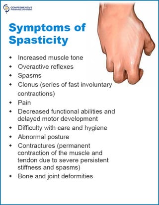 Spasticité Spasticity | PDF