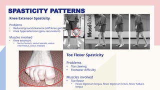 Spacicity Problem Body Spasticity in Rehabilitation Medicine by Rahimi Rusli | PPTX