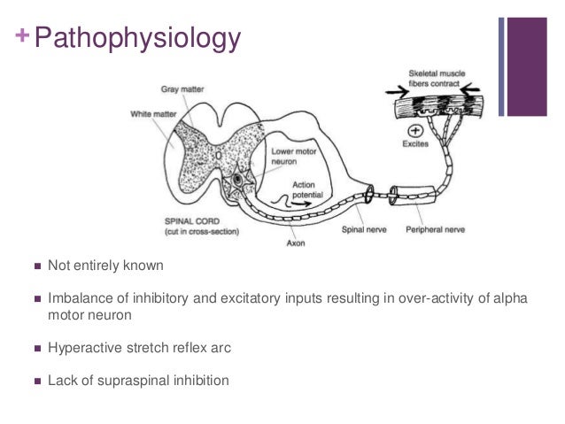 Spasticity management after stroke