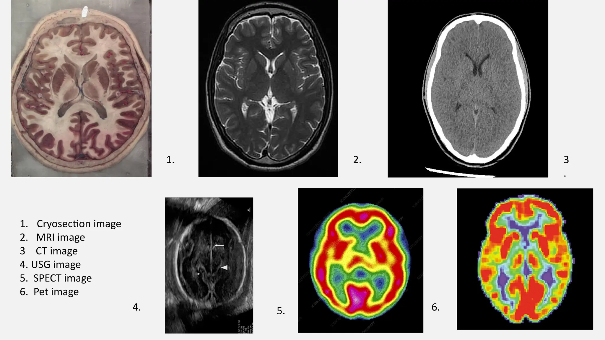 1. Cryosection image
2. MRI image
3 CT image
4. USG image
5. SPECT image
6. Pet image
1. 2. 3
.
5. 6.
4.
 