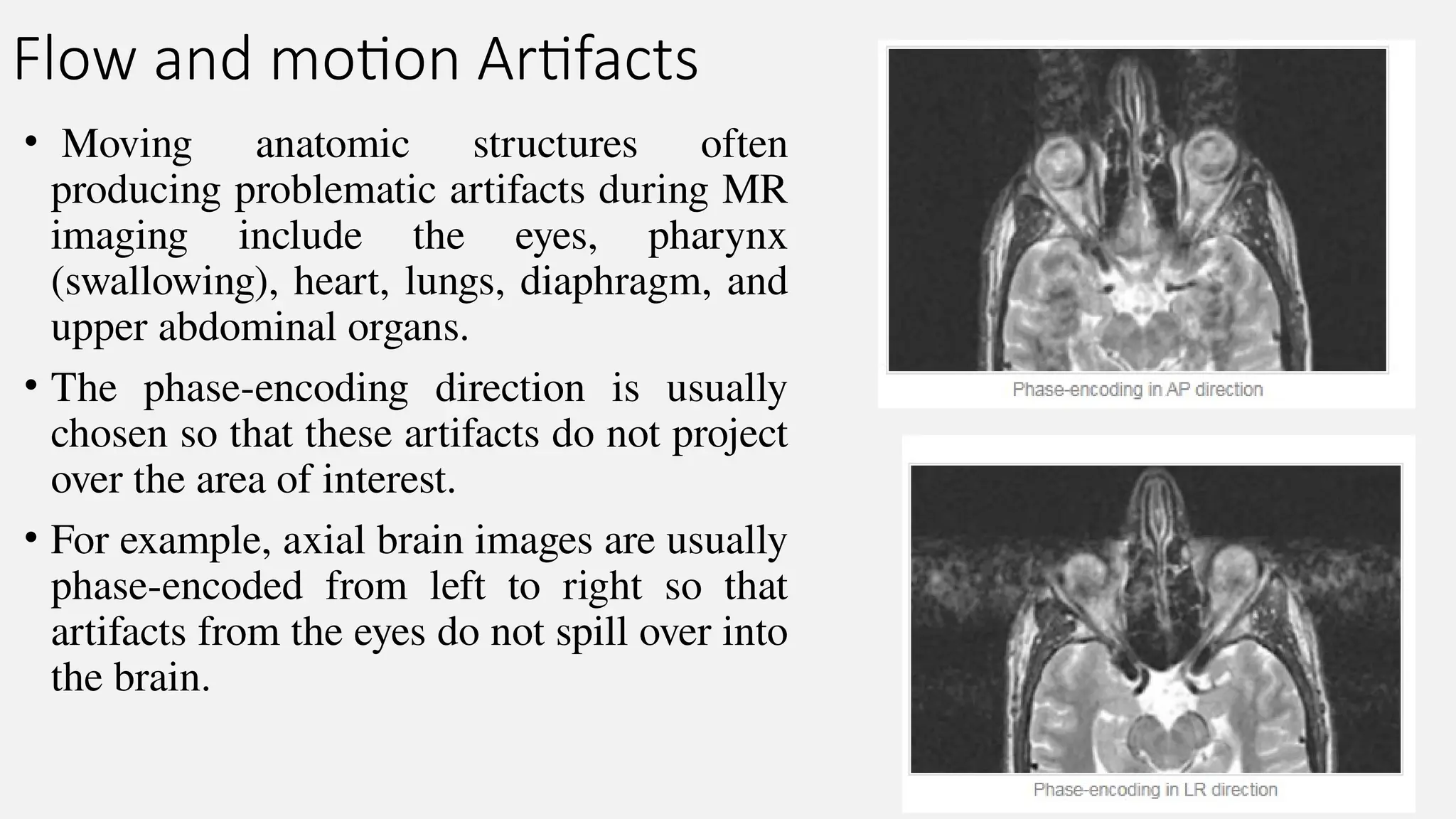 Flow and motion Artifacts
• Moving anatomic structures often
producing problematic artifacts during MR
imaging include the eyes, pharynx
(swallowing), heart, lungs, diaphragm, and
upper abdominal organs.
• The phase-encoding direction is usually
chosen so that these artifacts do not project
over the area of interest.
• For example, axial brain images are usually
phase-encoded from left to right so that
artifacts from the eyes do not spill over into
the brain.
 