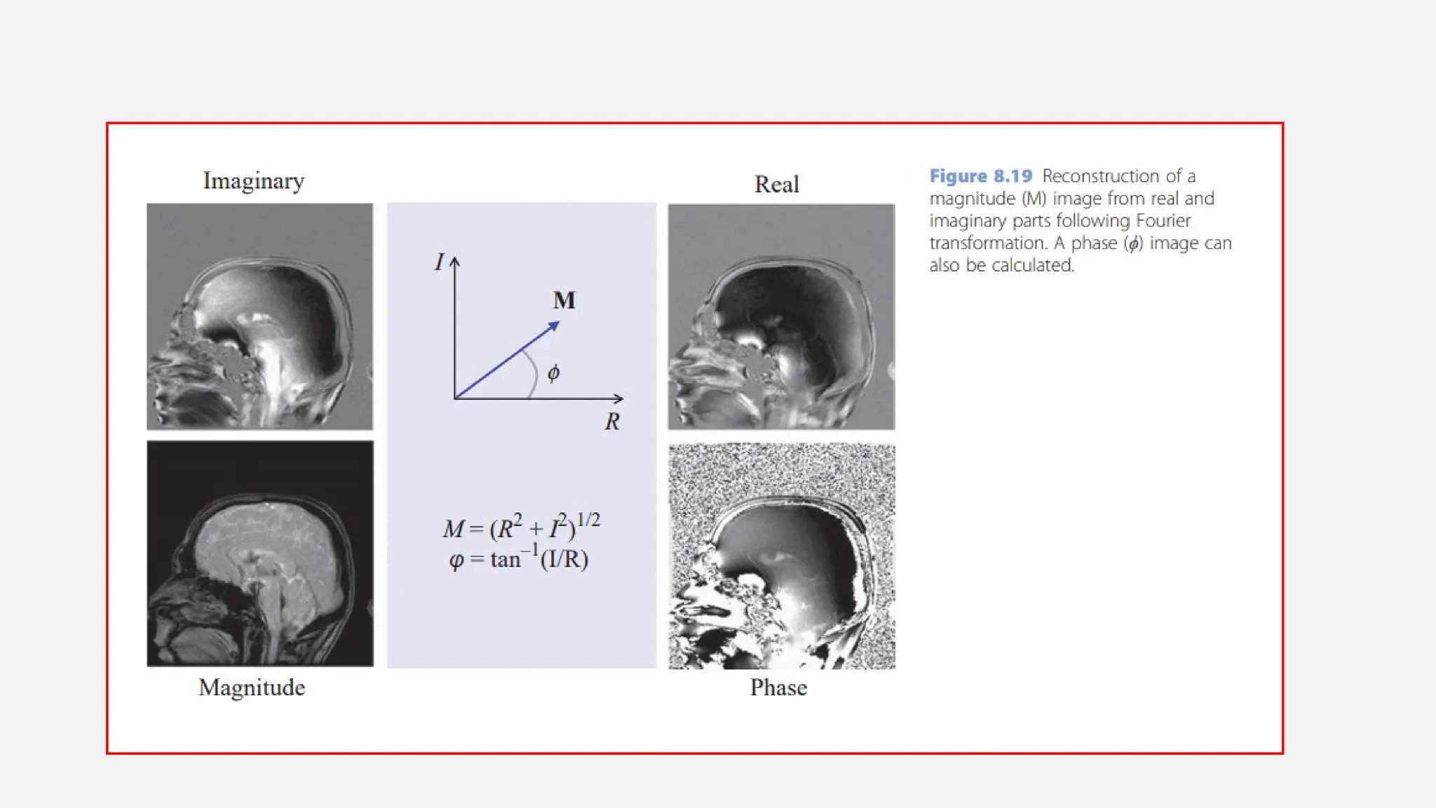 SPATIAL ENCODING AND IMAGE formation in MRI.pptx