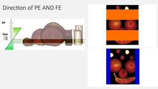 Direction of PE AND FE
 