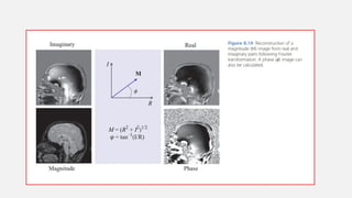 SPATIAL ENCODING AND IMAGE formation in MRI.pptx