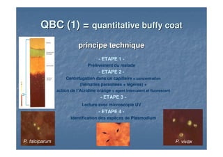 QBC (1) =QBC (1) = quantitativequantitative buffybuffy coatcoat
principe techniqueprincipe technique
- ETAPE 1 -
Prélèvement du malade
- ETAPE 2 -
Centrifugation dans un capillaire = concentration
(hématies parasitées + légères) +
action de l’Acridine orange = agent intercalent et fluorescent
- ETAPE 3 -
Lecture avec microscopie UV
- ETAPE 4 -
Identification des espèces de Plasmodium
P. falciparum P. vivax
 