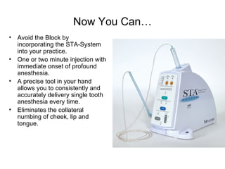 Rsta Spray Injection Speaker Sta Slides, Script Erc Compressed | PPT