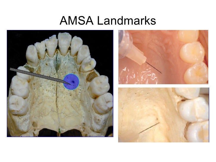 Speaker Sta Slides, Script Erc Compressed