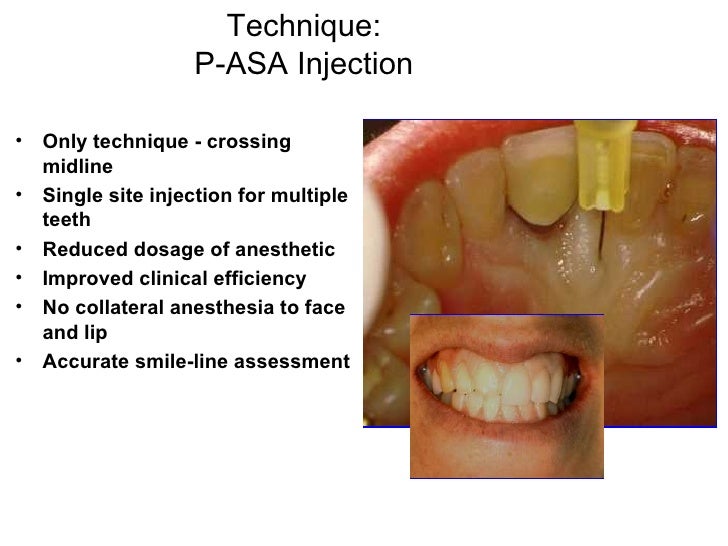 Speaker Sta Slides, Script Erc Compressed