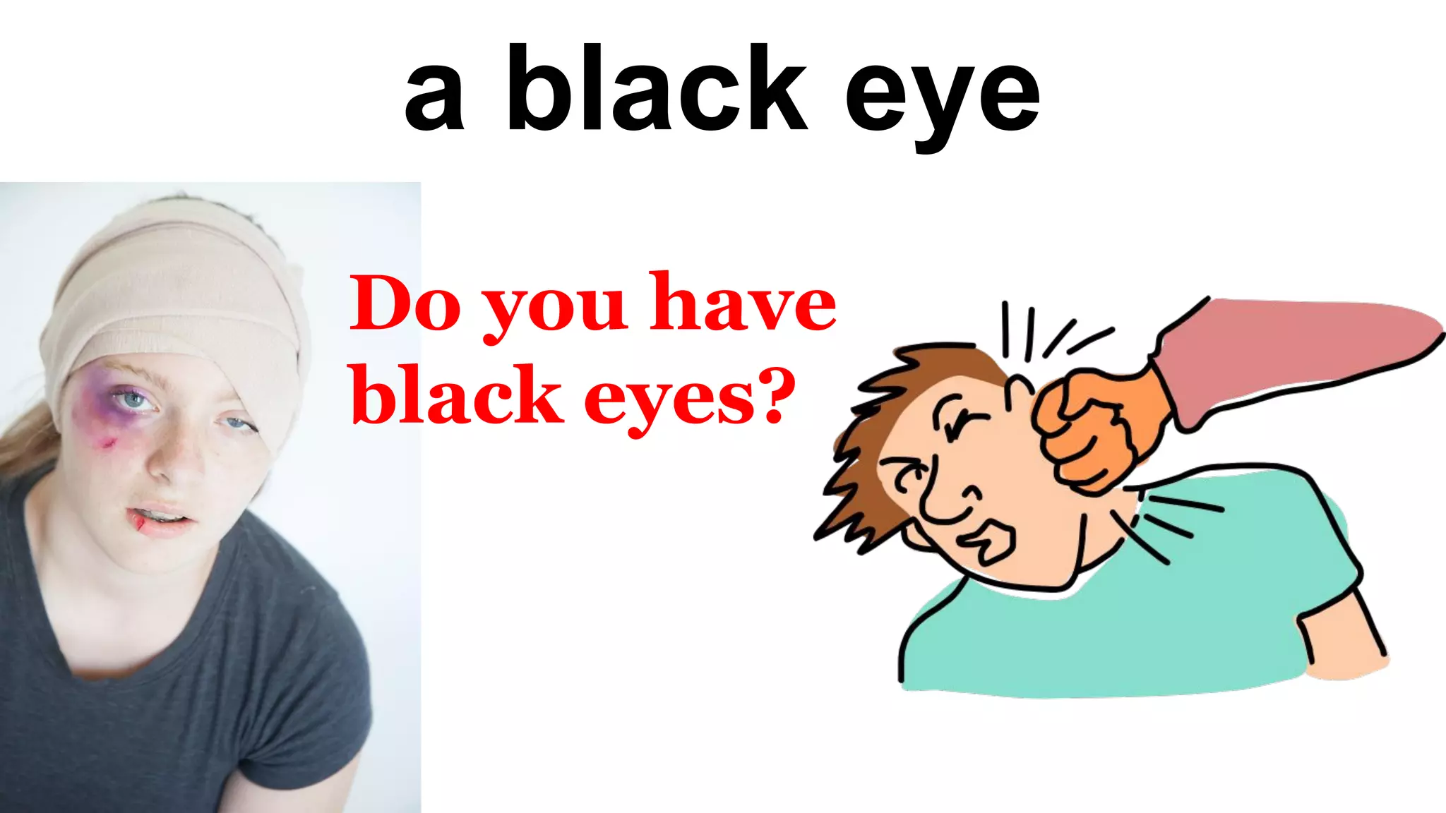 a black eye
Do you have
black eyes?
 