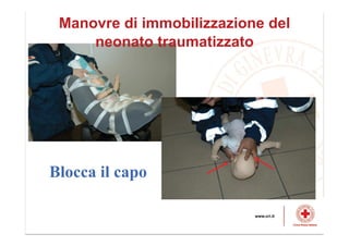 Blocca il capo
Manovre di immobilizzazione del
neonato traumatizzato
 