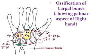 Ossification of
Carpal bones
(showing palmar
aspect of Right
hand)
 