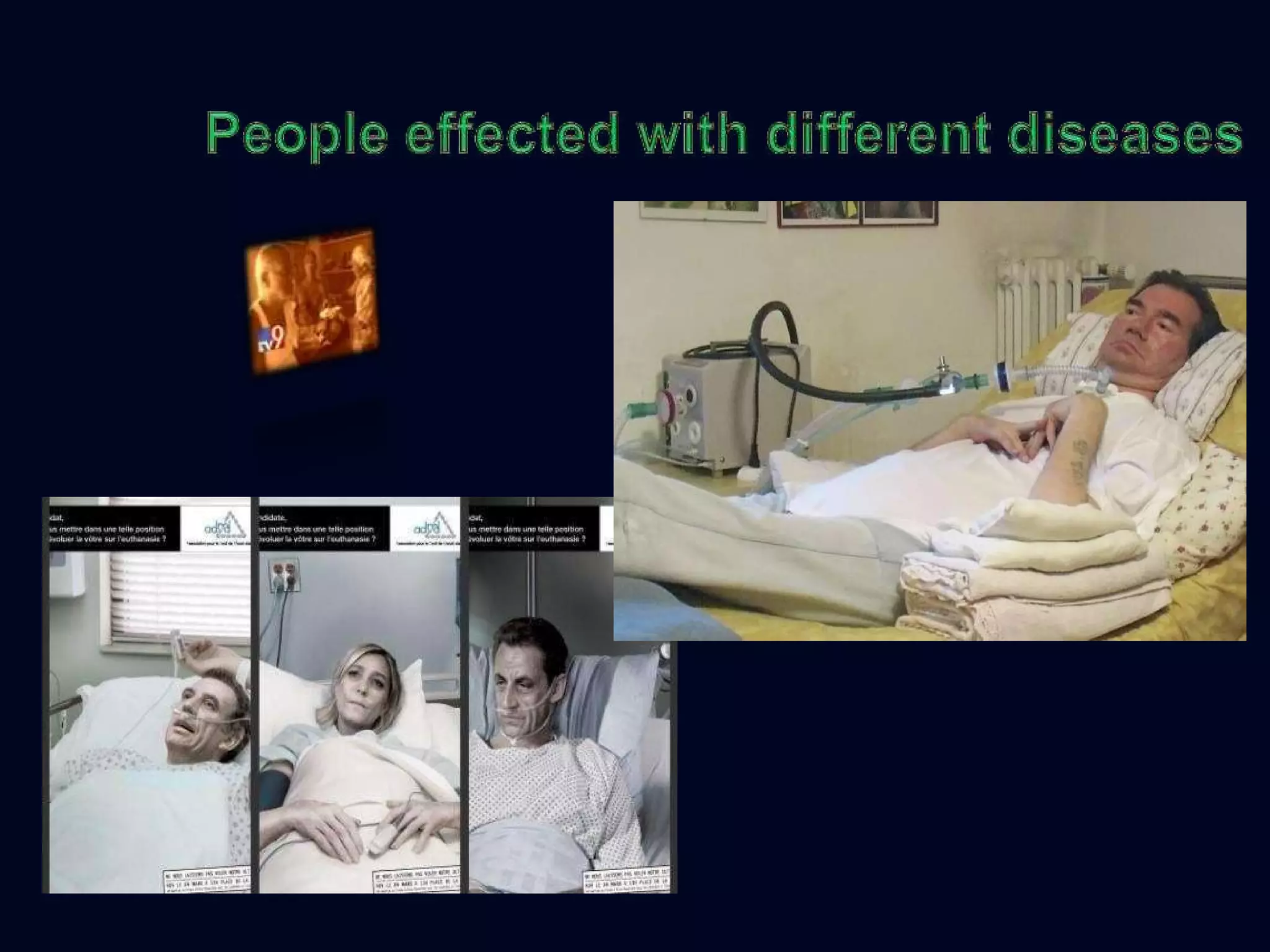 Special consideration advance directives,Euthanasia