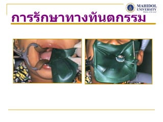 การรักษาทางทันตกรรม
 