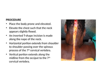 PROCEDURE
• Place the body prone and elevated.
• Elevate the chest such that the neck
appears slightly flexed.
• An inverted T-shape incision is made
along the nape of the neck.
• Horizontal portion extends from shoulder
to shoulder passing over the spinous
process of the 7th
cervical vertebra.
• Vertical portion extends along the
midline from the occiput to the 7th
cervical vertebra.
 