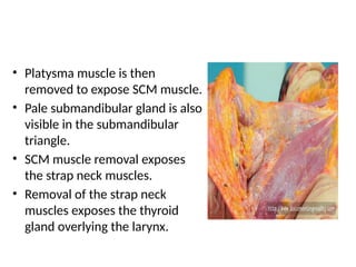 • Platysma muscle is then
removed to expose SCM muscle.
• Pale submandibular gland is also
visible in the submandibular
triangle.
• SCM muscle removal exposes
the strap neck muscles.
• Removal of the strap neck
muscles exposes the thyroid
gland overlying the larynx.
 