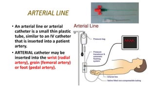 Special equipment in icu | PPTX