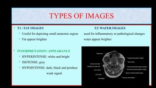 TYPES OF IMAGES
 T1 / FAT IMAGES T2/ WATER IMAGES
 Useful for depicting small anatomic region used for inflammatory or pathological changes
 Fat appear brighter water appear brighter
 INTERPRETATION/ APPEARANCE
 HYPERINTENSE: white and bright
 ISOTENSE: grey
 HYPOINTENSE: dark, black and produce
weak signal
 
