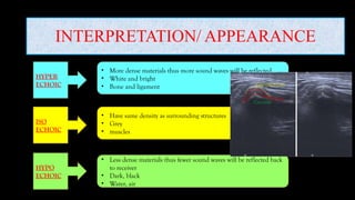 INTERPRETATION/ APPEARANCE
• More dense materials thus more sound waves will be reflected
• White and bright
• Bone and ligament
• Have same density as surrounding structures
• Grey
• muscles
HYPER
ECHOIC
ISO
ECHOIC
HYPO
ECHOIC
• Less dense materials thus fewer sound waves will be reflected back
to receiver
• Dark, black
• Water, air
 
