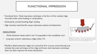special impression procedures for tooth- tissue supported RPD.pptx