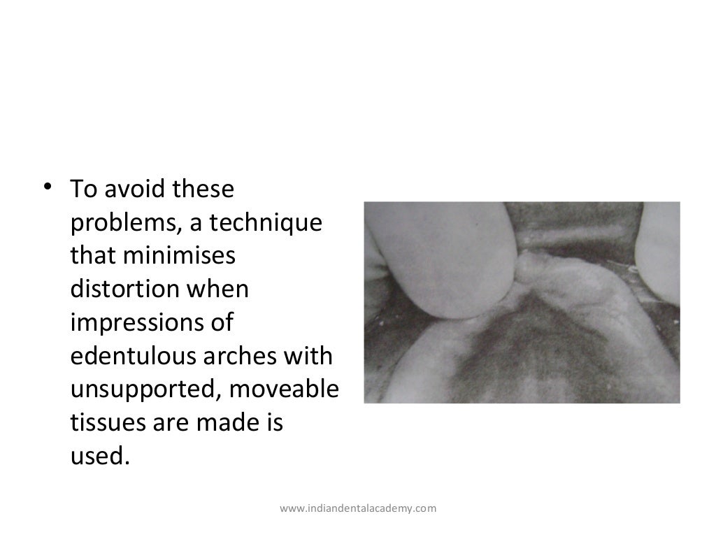 Special impression techniques/ dentistry dental implants