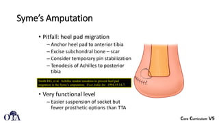 Special Issues13 Amputations of the Lower Extremity.pdf