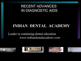 RECENT ADVANCES
IN DIAGNOSTIC AIDS

INDIAN DENTAL ACADEMY
Leader in continuing dental education
www.indiandentalacademy.com

www.indiandentalacademy.com

 