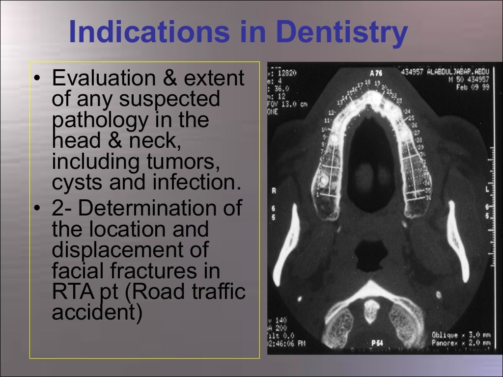 Specialised Techniques in Oral Radiology