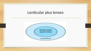 Plus Lens Example Special lens design for better vision and cosmesis | PPTX
