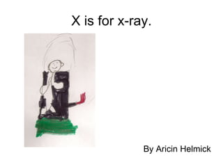 X is for x-ray. <ul><li>By Aricin Helmick </li></ul>