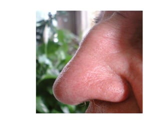 Middle ear structures are the ossicles and auditory tube within the tympanic cavity. The ossicles (malleus, incus, and stapes)transmit the vibratory motion from the eardrum to the oval window. The auditory tube allows pressure to be equalized on both sides of the eardrum. These structures are also involved with sound transmission only. 