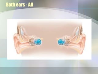 Both ears - AU
 