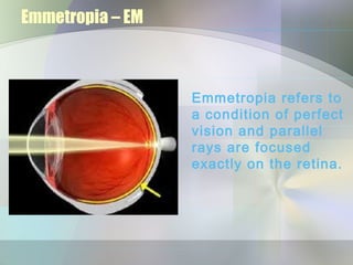 Emmetropia – EM



                  Emmetropia refers to
                  a condition of perfect
                  vision and parallel
                  rays are focused
                  exactly on the retina.
 