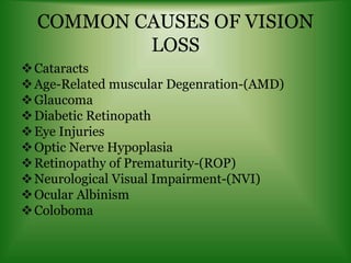 COMMON CAUSES OF VISION
LOSS
Cataracts
Age-Related muscular Degenration-(AMD)
Glaucoma
Diabetic Retinopath
Eye Injuries
Optic Nerve Hypoplasia
Retinopathy of Prematurity-(ROP)
Neurological Visual Impairment-(NVI)
Ocular Albinism
Coloboma
 