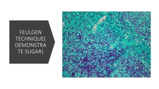 FEULGEN
TECHNIQUE(
DEMONSTRA
TE SUGAR)
 