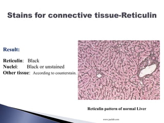 Special stain dr kamlesh | PPTX