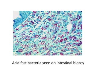 Acid fast bacteria seen on intestinal biopsy
 