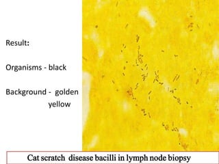 Result:
Organisms - black
Background - golden
yellow
Cat scratch disease bacilli in lymph node biopsy
 