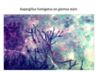 Aspergillus fumigatus on giemsa stain
 