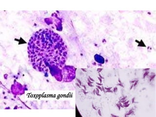 Toxoplasma gondii
 