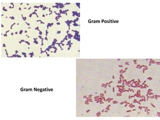 Gram Positive
Gram Negative
 